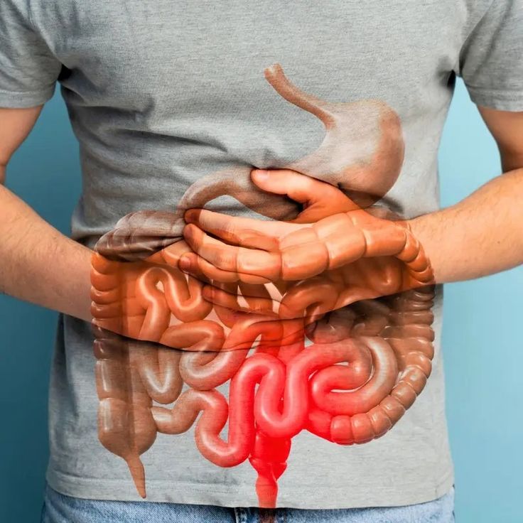 Brelixa™  - GUT SUPPORT CAPSULE